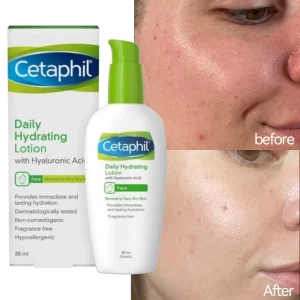 Cetaphil Hyaluronic Acid Hydrating Cream Whitening Moisturizing Cream Nourishing Body Lotion Cream For Face Skin Care Body 88ML