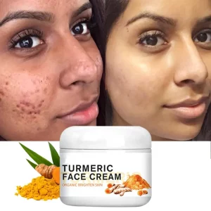 Turmeric Face Whitening Cream for Dark Skin Remove Acne Lighten Dark Spots Moisturizing Brightening Cream for Face Skin Care